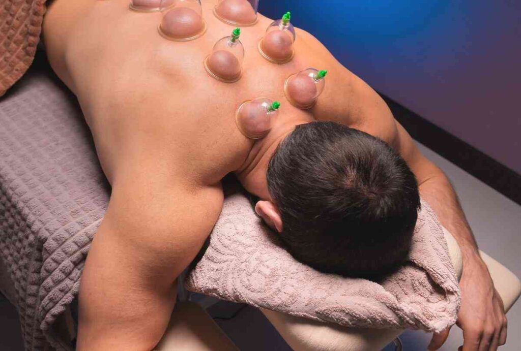 Cupping Therapy in Doha