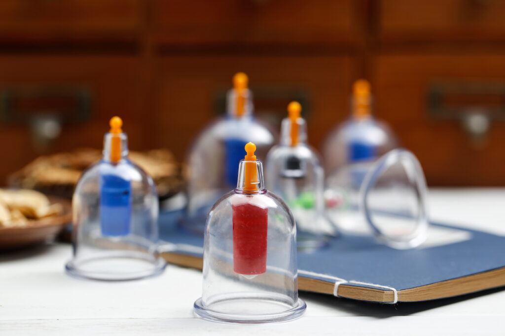 Patient receiving hijama therapy at a clean and professional clinic near Doha.