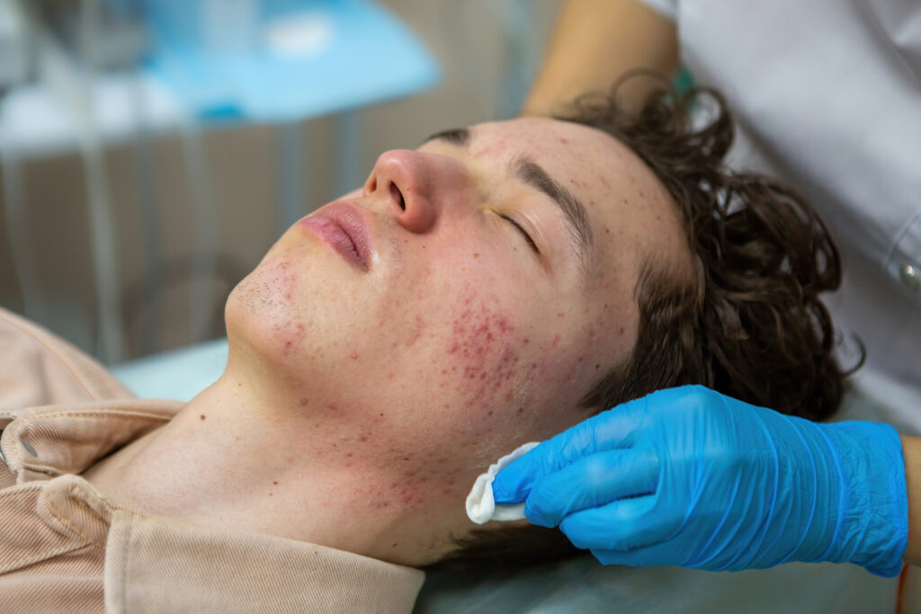 Skin Specialist in Doha