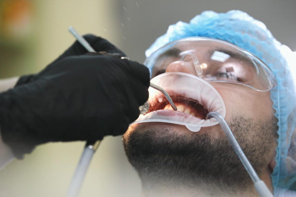 Professional scaling and teeth cleaning treatment in Qatar