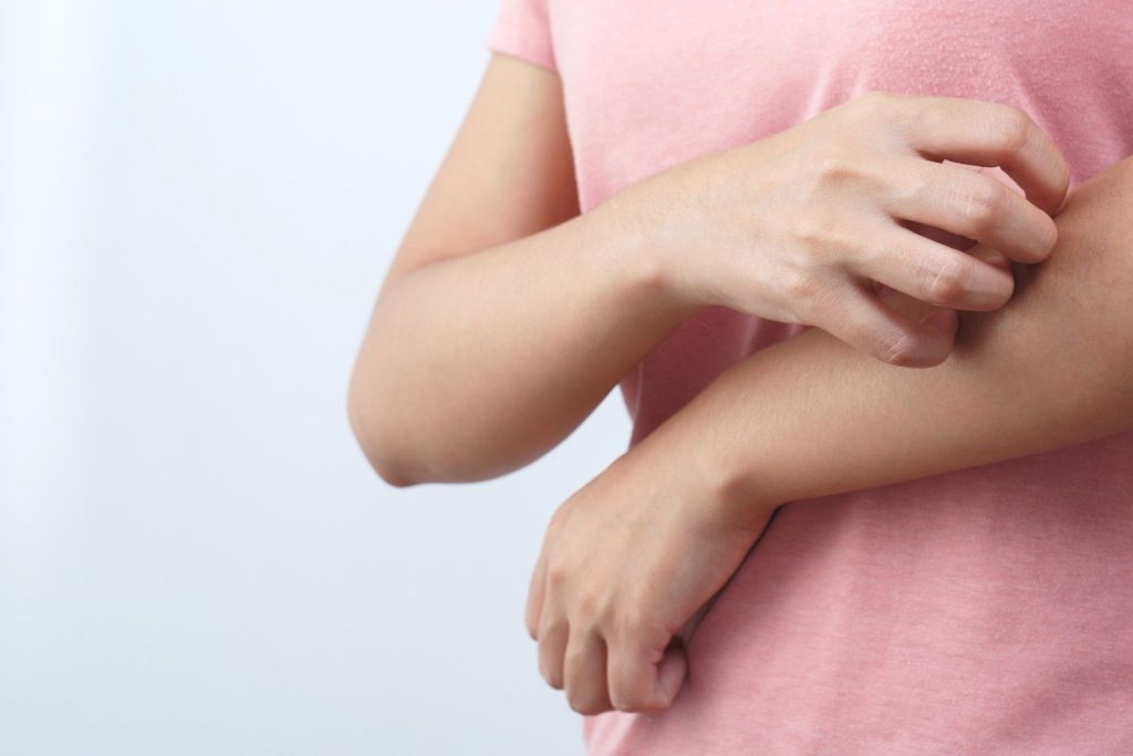 Prickly heat and heat rash during summer