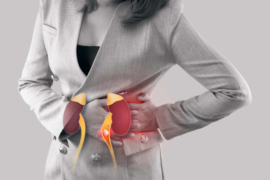 Kidney stones during Qatar's summer heat