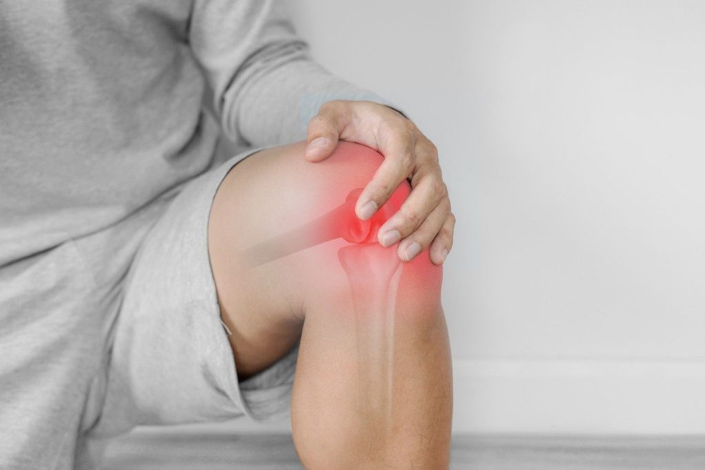 Swollen knee joint in hot summer weather.