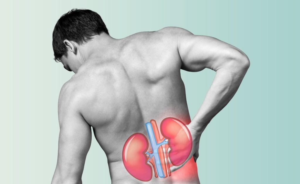 Foods and drinks that increase kidney stone risk